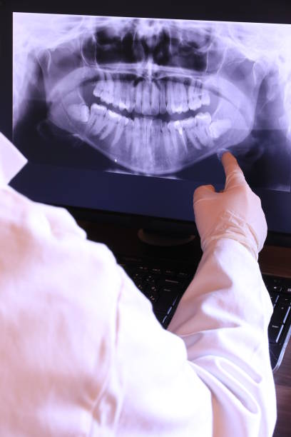 Best Broken or Chipped Tooth Repair in Hunters Creek, FL