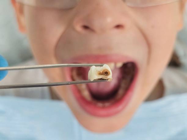 Best Walk-In Emergency Dental Services in Hunters Creek, FL